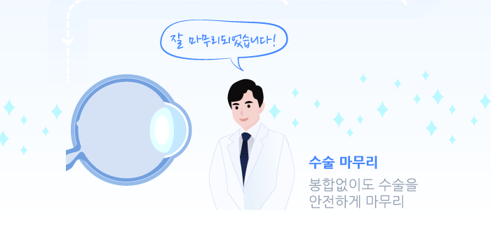 다초점 노안 백내장 수술이란? / 강남 스마일안과,강남 안과 추천 사진 7