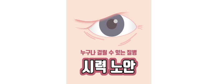 [老花眼] 老花眼的原因是什麼？透過自我檢測來了解吧！