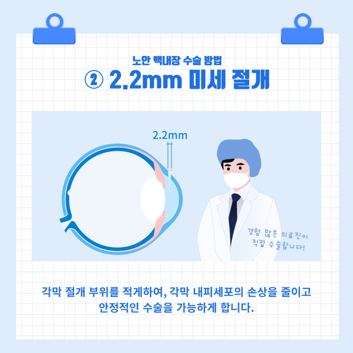 [노안/백내장] 백내장과 노안, 굴절이상을 동시에 교정하는 노안 백내장 수술! 사진 4
