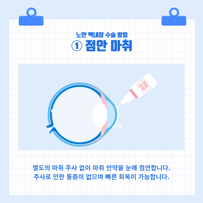 [노안/백내장] 백내장과 노안, 굴절이상을 동시에 교정하는 노안 백내장 수술! 사진 3