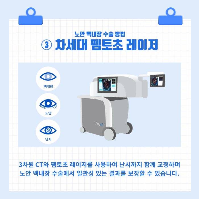 [노안/백내장] 백내장과 노안, 굴절이상을 동시에 교정하는 노안 백내장 수술! 사진 5