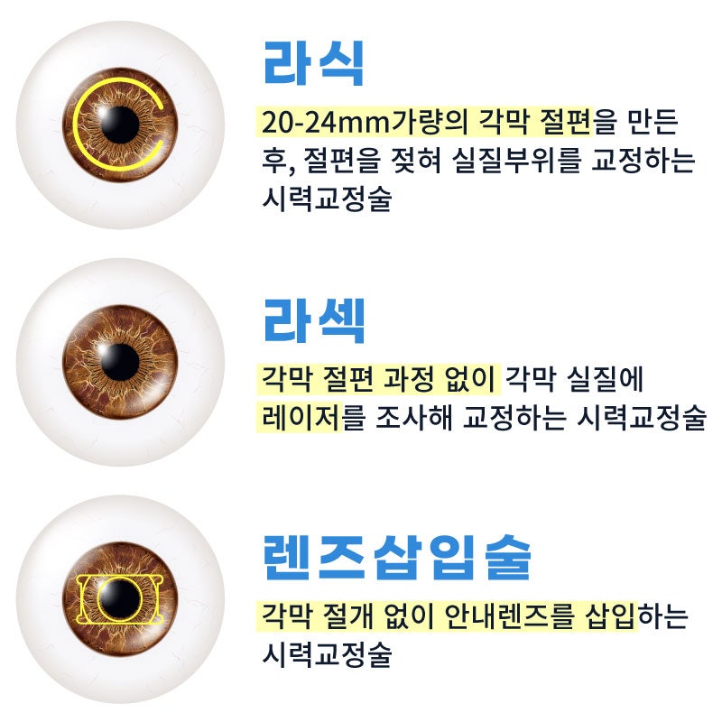 『江南スマイル眼科』20代の視力矯正術、こんなに種類があるんです! 사진 2