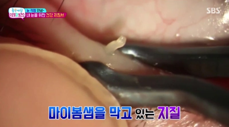Video SBS Good Morning 'Wednesday N Health Center' Smile Doctor Yeom Sabu TV đã ra mắt! 사진 4