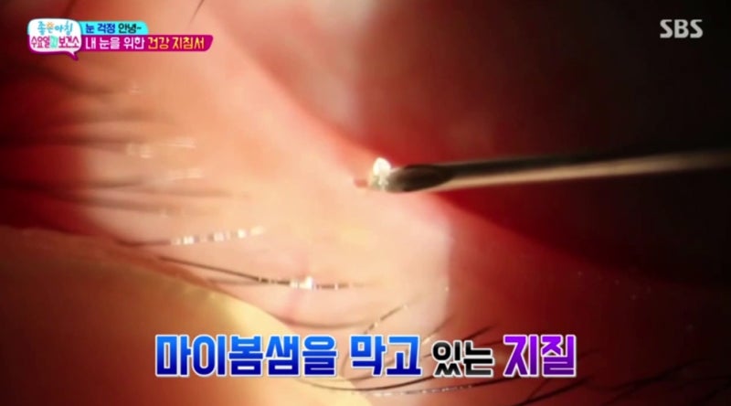 Video SBS Good Morning 'Wednesday N Health Center' Smile Doctor Yeom Sabu TV đã ra mắt! 사진 5