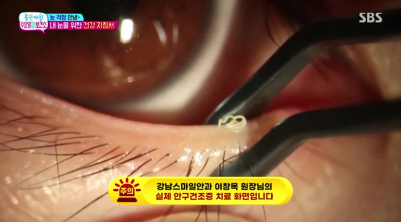 Video SBS Good Morning 'Wednesday N Health Center' Smile Doctor Yeom Sabu TV đã ra mắt! 사진 3