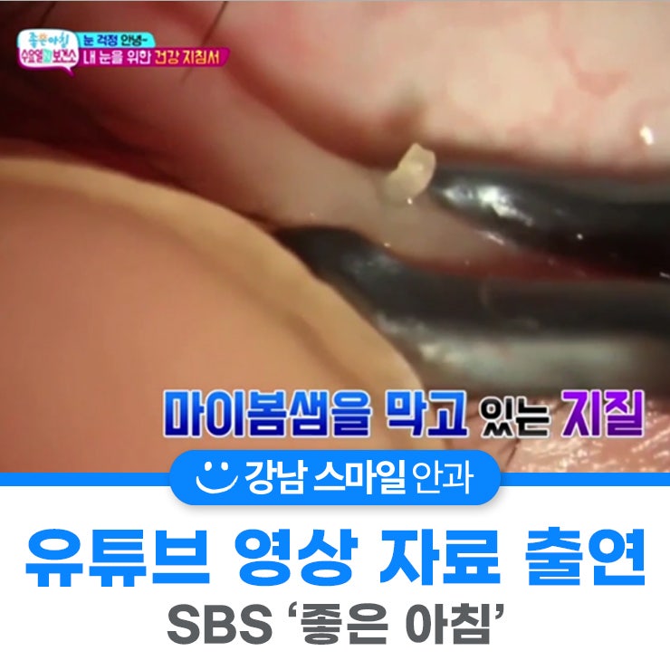 SBS Good Morning 'Wednesday N Public Health Center' Smile Doctor Yeom Sabu TV video is out!