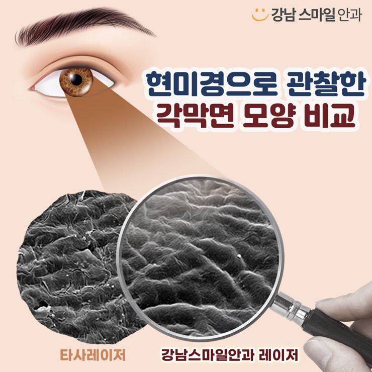 您曾擔心過雷射視力矯正的角膜厚度嗎？ 사진 4
