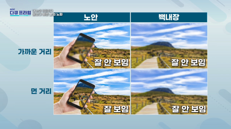 [MBC 다큐프라임 401회] 강남스마일안과 윤효성 원장님 방송 출연 사진 16