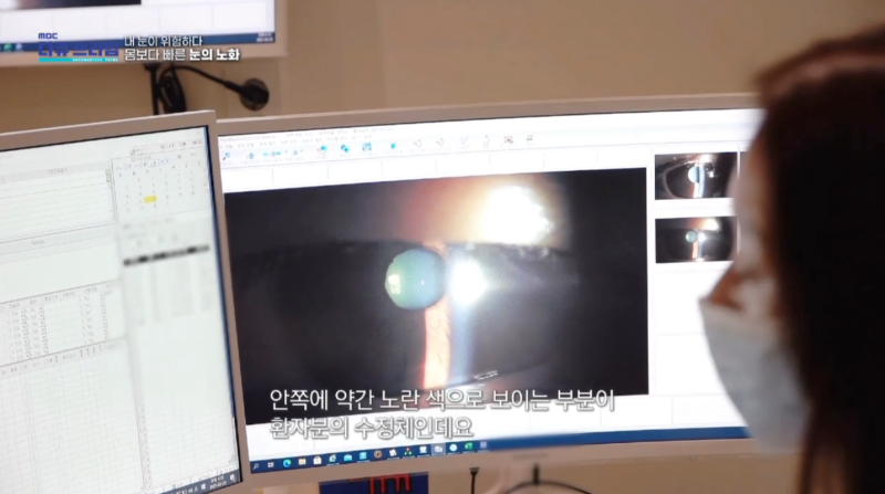 [MBC 다큐프라임 401회] 강남스마일안과 윤효성 원장님 방송 출연 사진 9