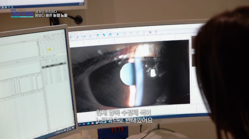 [MBC 다큐프라임 401회] 강남스마일안과 윤효성 원장님 방송 출연 사진 10