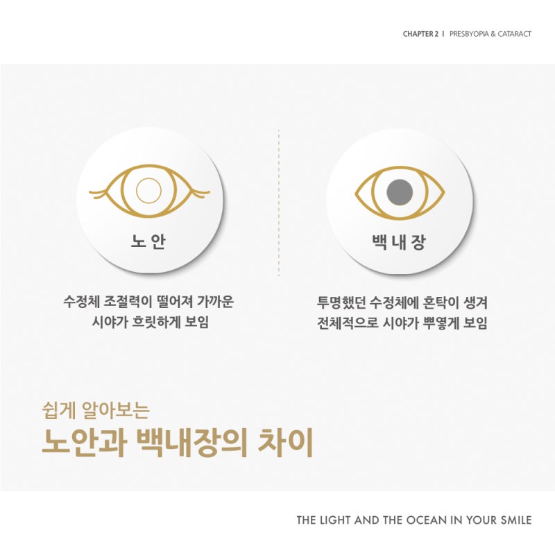 江南Smile眼科《拯救雙眼：老花眼&白內障篇》 사진 4