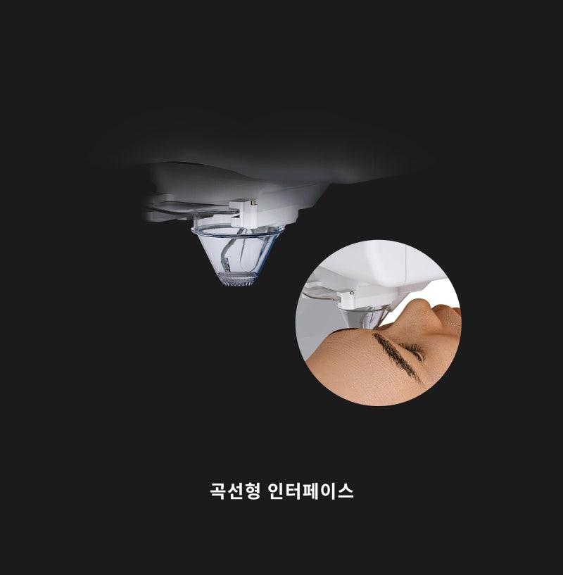 Gangnam Smile Eye Clinic นำเข้าอุปกรณ์ผ่าตัด New Smile LASIK รุ่น Schwind ATOS (ชวินด์ อะทอส)! 사진 7