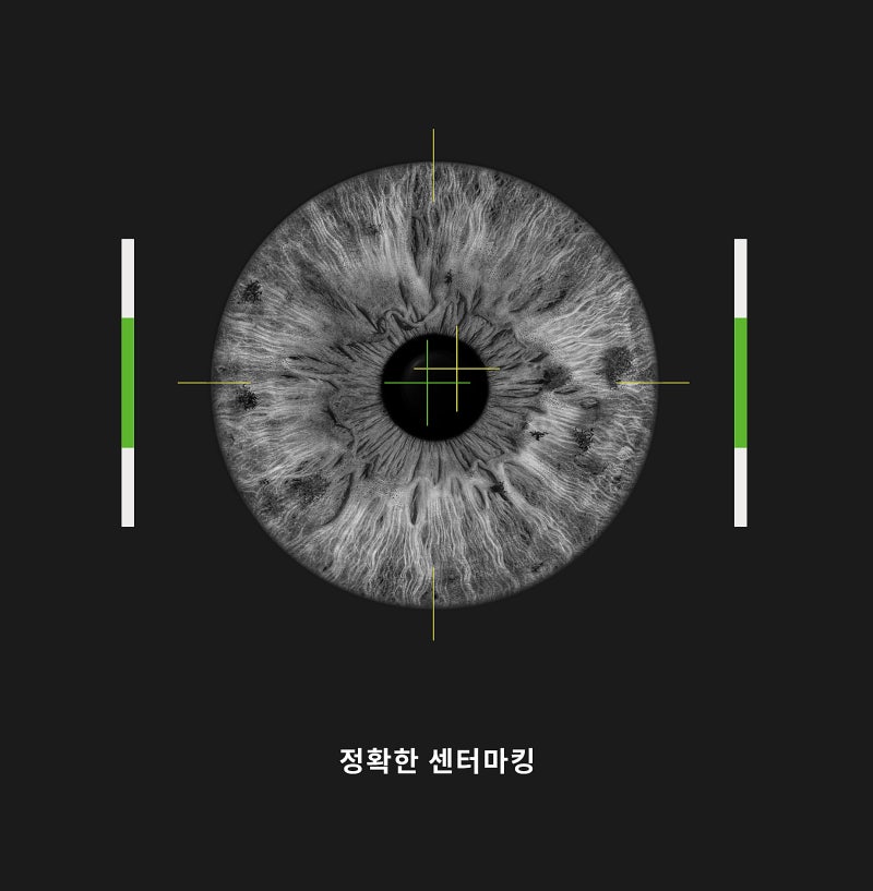 Gangnam Smile Eye Clinic นำเข้าอุปกรณ์ผ่าตัด New Smile LASIK รุ่น Schwind ATOS (ชวินด์ อะทอส)! 사진 5
