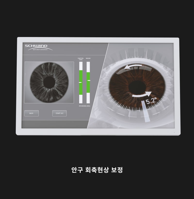 Gangnam Smile Eye Clinic นำเข้าอุปกรณ์ผ่าตัด New Smile LASIK รุ่น Schwind ATOS (ชวินด์ อะทอส)! 사진 6