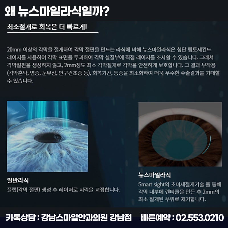 LASIK与LASEK的区别:在江南Smile眼科慎重选择视力矫正手术 사진 13