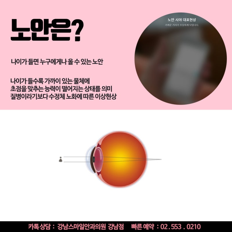 Why Presbyopia and Cataracts Are Often Confused, and Why Regular Eye Exams Are Essential! 사진 4