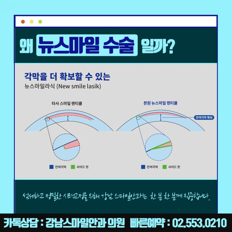 การผ่าตัด Newsmile ในโซล, Gangnam Smile Eye Clinic ที่รู้จักกันดีในเรื่อง Lasik และ Lasek : ) 사진 16