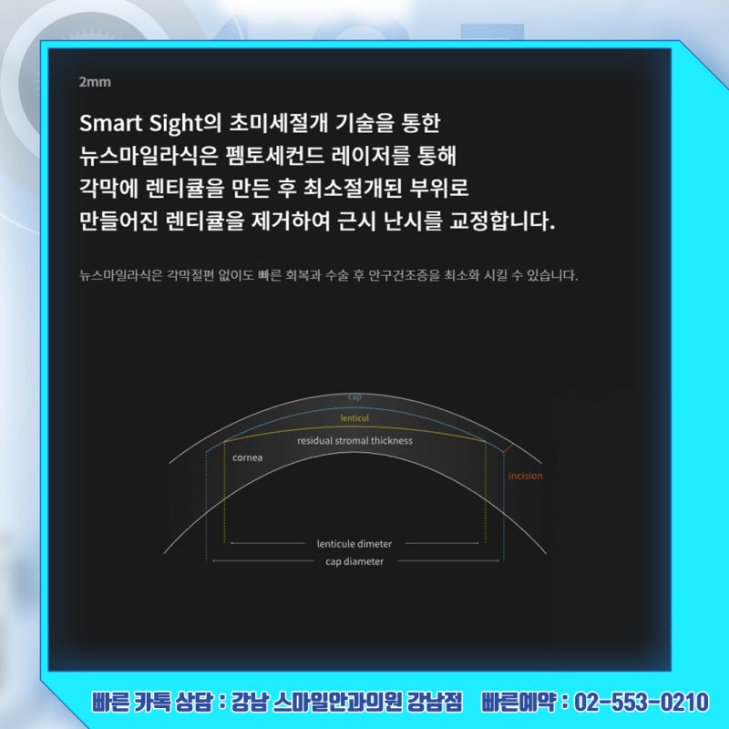 重获视力，纽飞秒激光手术价格咨询请到江南Smile眼科 사진 10