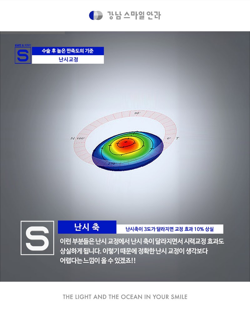 การแก้ไขสายตาเอียงอย่างแม่นยำด้วย New Smile จาก Gangnam Smile Eye Clinic 사진 9
