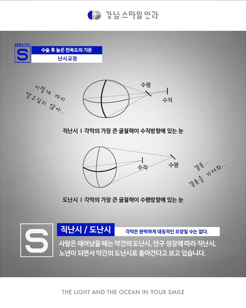 การแก้ไขสายตาเอียงอย่างแม่นยำด้วย New Smile จาก Gangnam Smile Eye Clinic 사진 5
