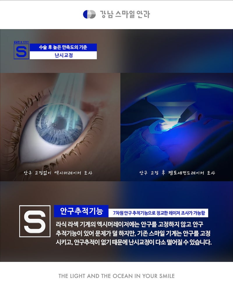 การแก้ไขสายตาเอียงอย่างแม่นยำด้วย New Smile จาก Gangnam Smile Eye Clinic 사진 8