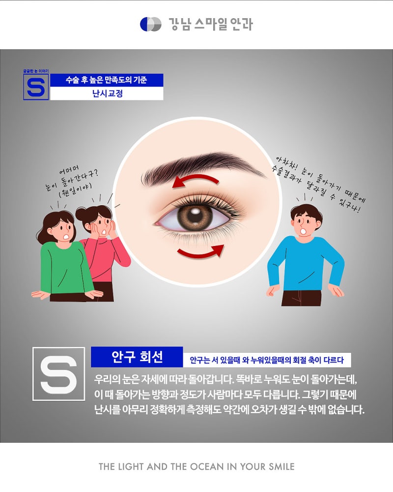 การแก้ไขสายตาเอียงอย่างแม่นยำด้วย New Smile จาก Gangnam Smile Eye Clinic 사진 7