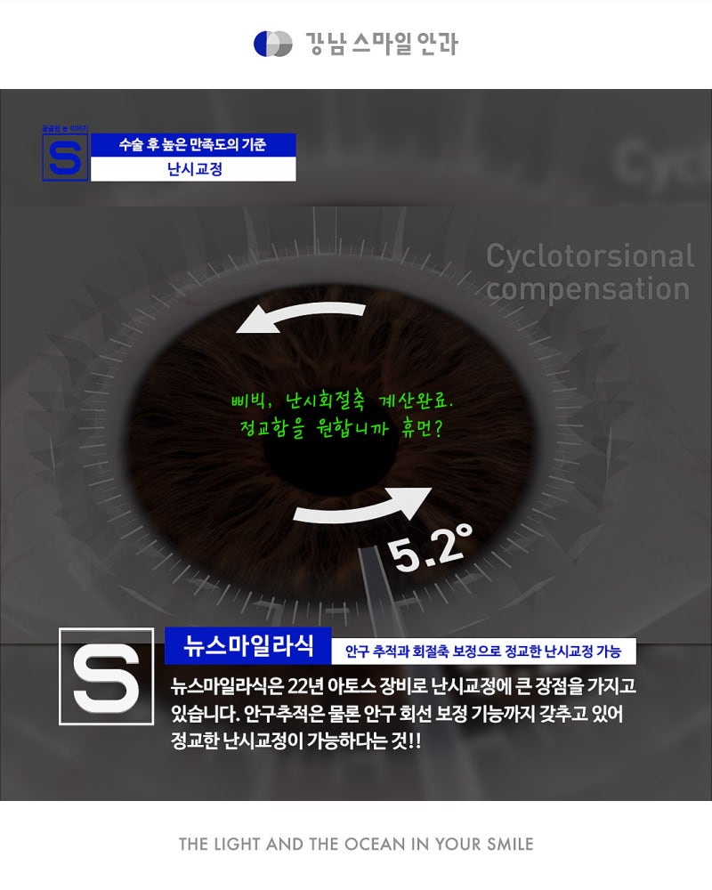 การแก้ไขสายตาเอียงอย่างแม่นยำด้วย New Smile จาก Gangnam Smile Eye Clinic 사진 10