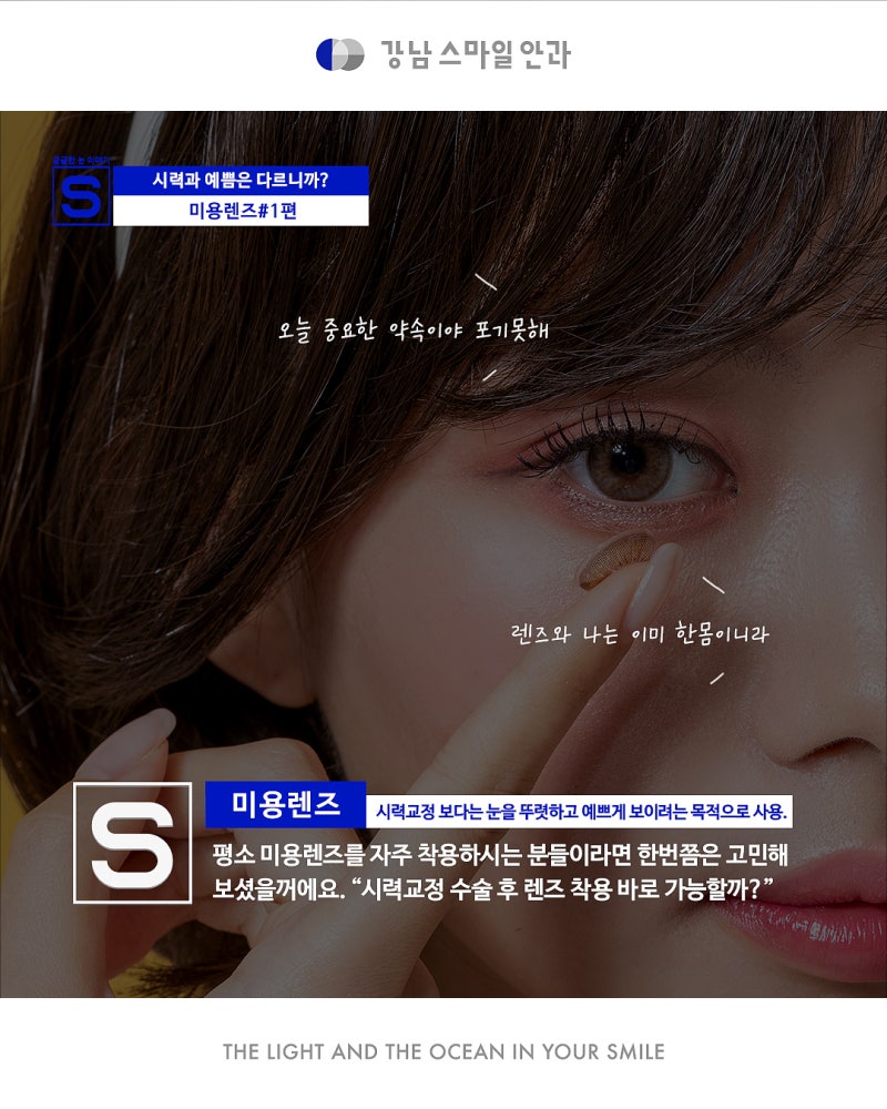 [강남역안과]시력교정수술 후 미용,서클렌즈 착용 괜찮을까?