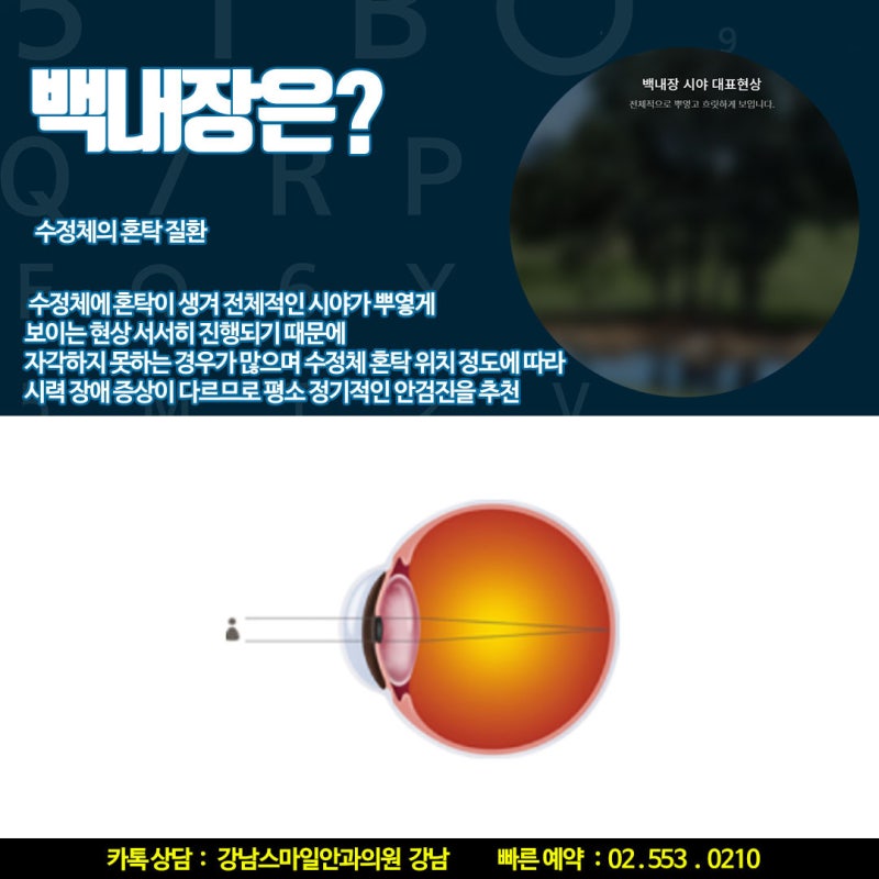 从老花眼矫正到白内障管理，江南眼科擅长定制手术 사진 6