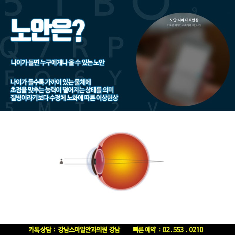 从老花眼矫正到白内障管理，江南眼科擅长定制手术 사진 5