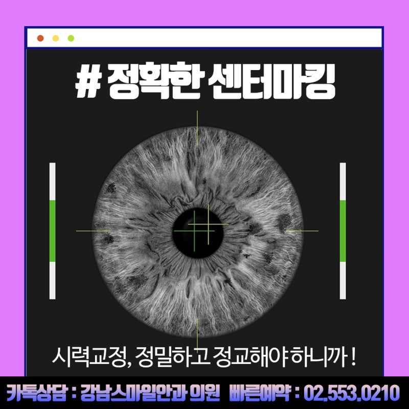 Операция Newsmile LASIK: точная коррекция даже при высокой степени астигматизма 사진 6