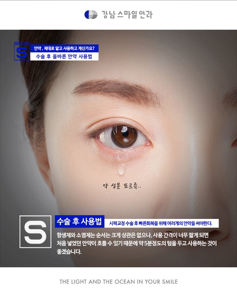 วิธีใช้ยาหยอดตาอย่างถูกต้องหลังการผ่าตัดแก้ไขสายตา (#LASIK #LASEK)!! 사진 7