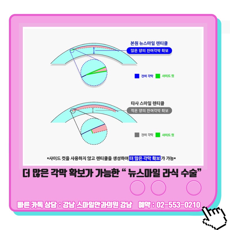 เหตุผลที่ควรไปพบจักษุแพทย์ที่ได้รับคำแนะนำสำหรับ Lasik/Lasek ในคังนัม 사진 9