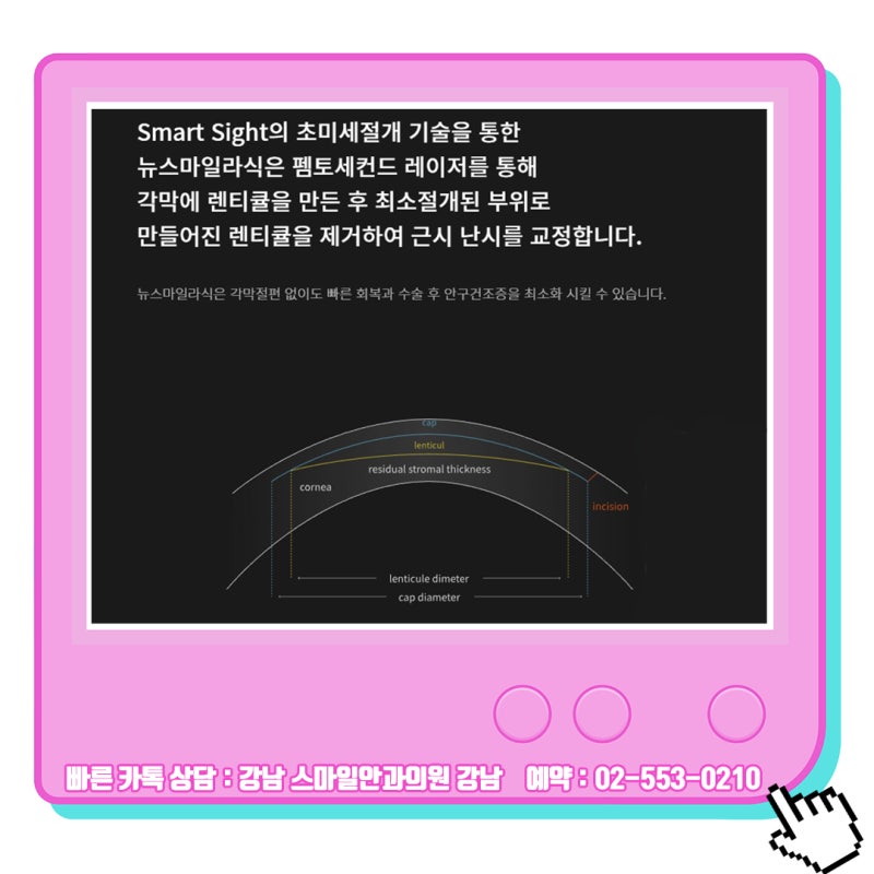 เหตุผลที่ควรไปพบจักษุแพทย์ที่ได้รับคำแนะนำสำหรับ Lasik/Lasek ในคังนัม 사진 6