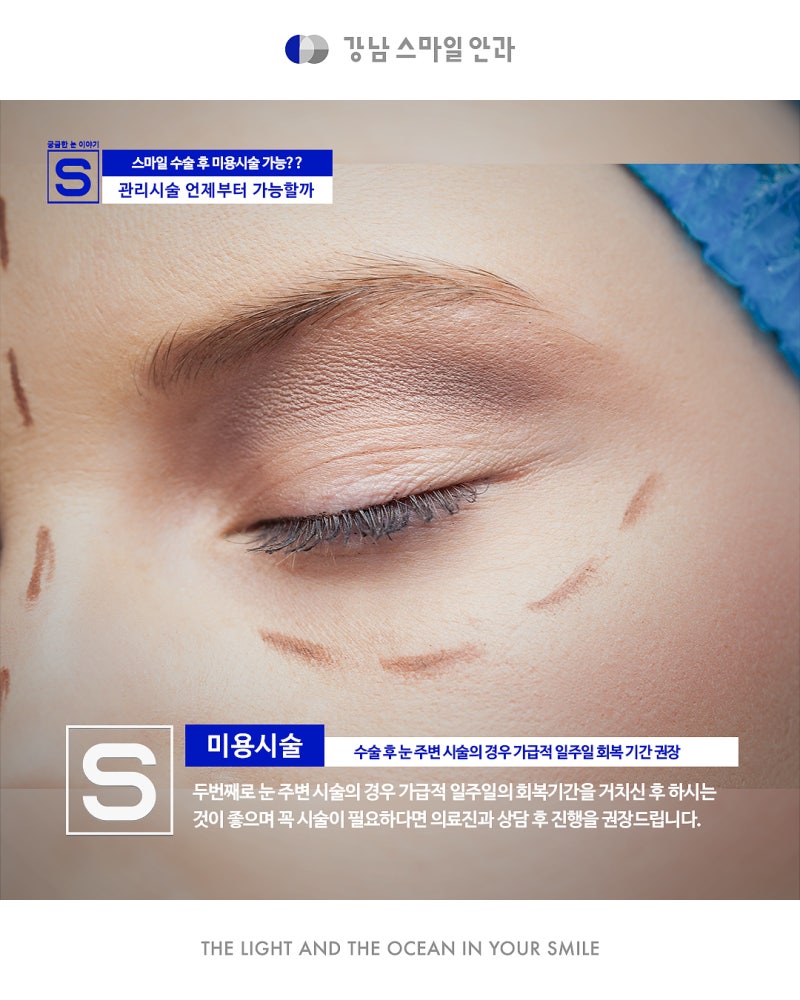 I want SMILE surgery and cosmetic procedures too!! What should I do? 사진 5