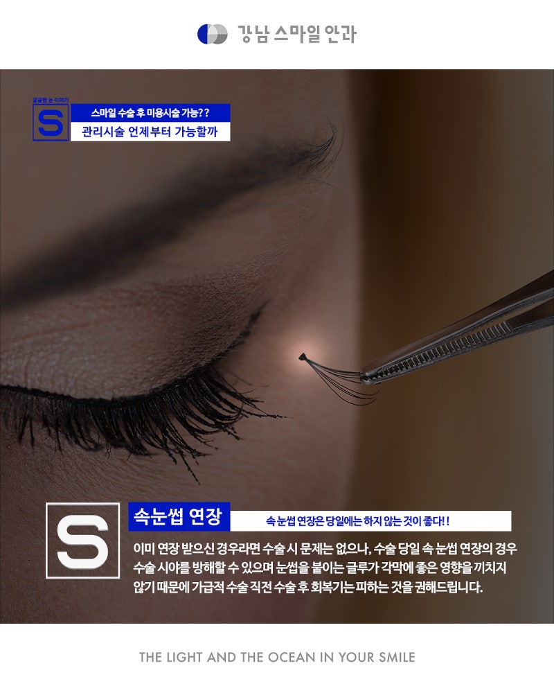 I want SMILE surgery and cosmetic procedures too!! What should I do? 사진 8