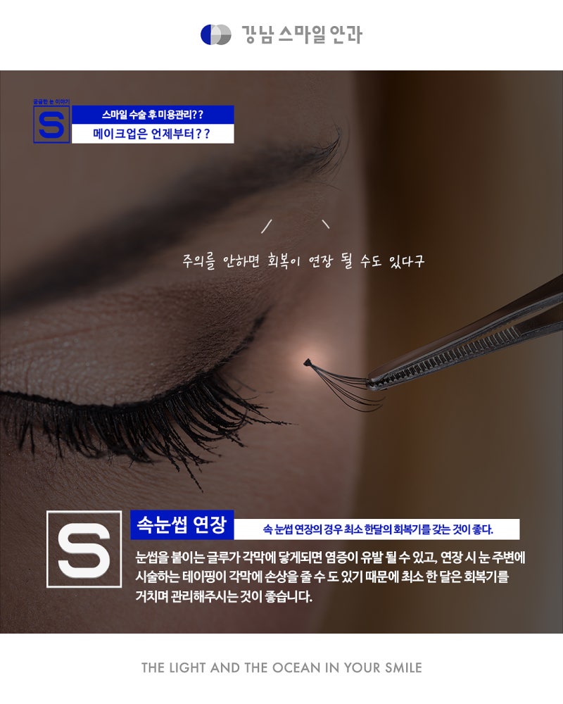 SMILE手术，视力矫正后化妆！何时可以开始？ 사진 7