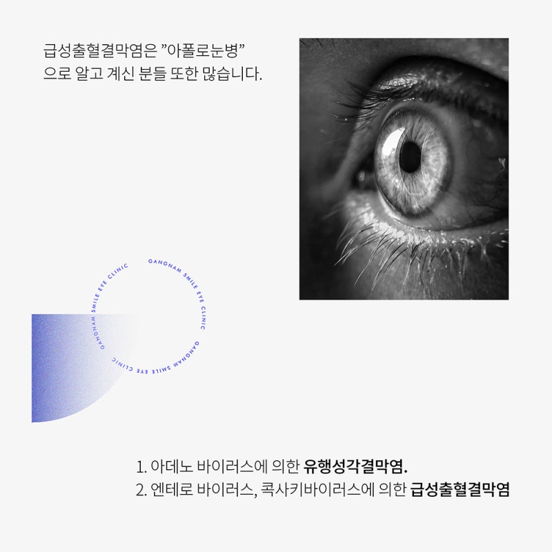 โรคตาที่สงสัยหลังฤดูร้อน?! ตรวจสอบที่ Gangnam Eye Clinic :)