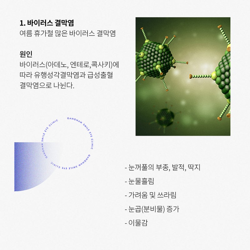Conjunctivitis We Might Experience! Eye Disease Management Also Checked at the Ophthalmologist!! 사진 4
