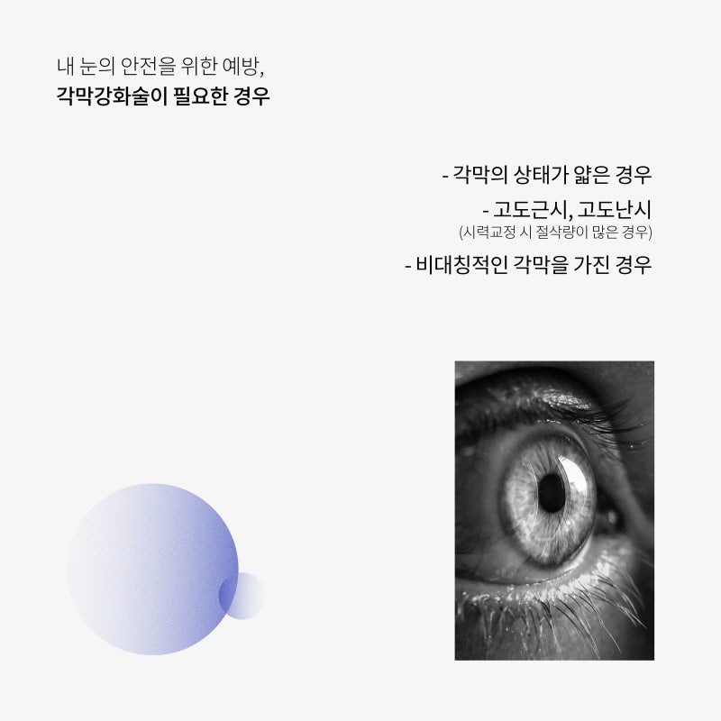 การผ่าตัด LASIK/LASEK จำเป็นต้องมีการเสริมความแข็งแรงของกระจกตาหรือไม่? 사진 3