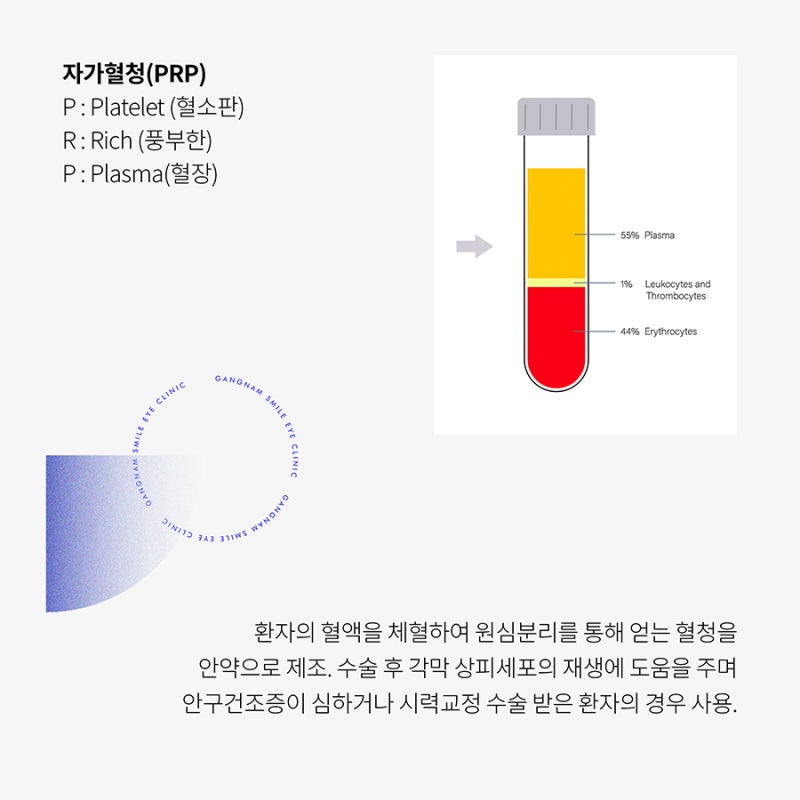 เซรั่มจากเลือดตัวเองในการผ่าตัด LASIK/LASEK คืออะไรกันนะ?