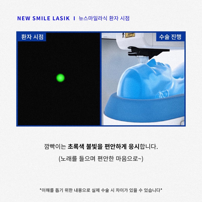 Góc nhìn của bệnh nhân phẫu thuật New Smile LASIK (ngôi thứ nhất) 사진 3
