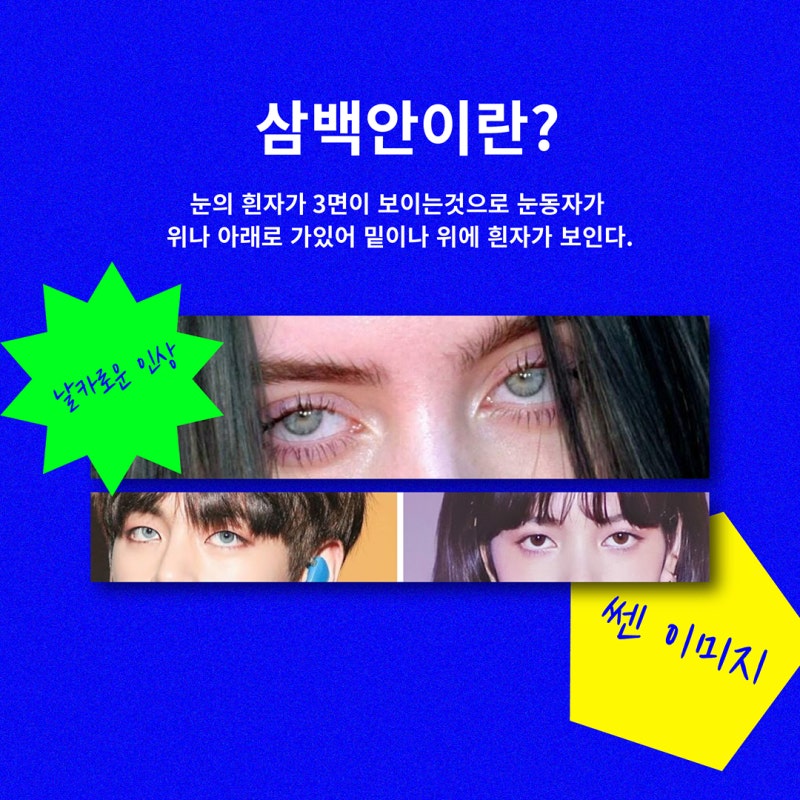 [눈동자 성형수술 아이링] 삼백안, 사백안이 고민이라면?