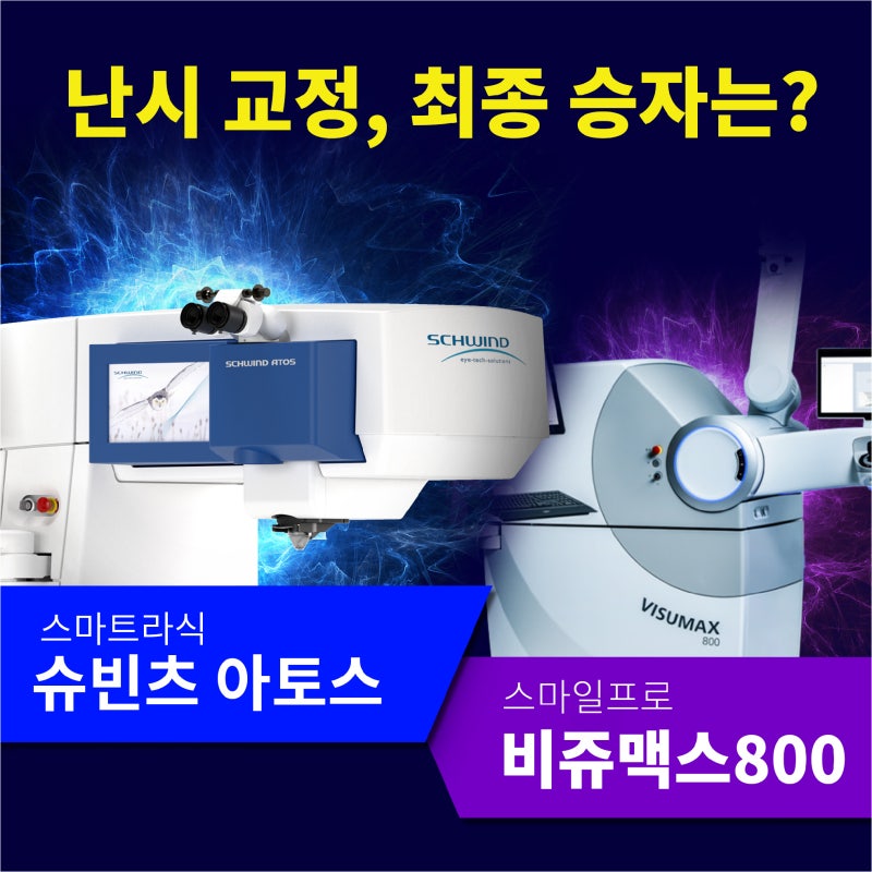 [第五代激光] Smart vs SMILE Pro，哪种更适合散光矫正？