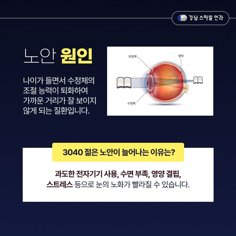 [江南Smile眼科] 如果出现老花眼早期症状，请务必接受检查！ 사진 3