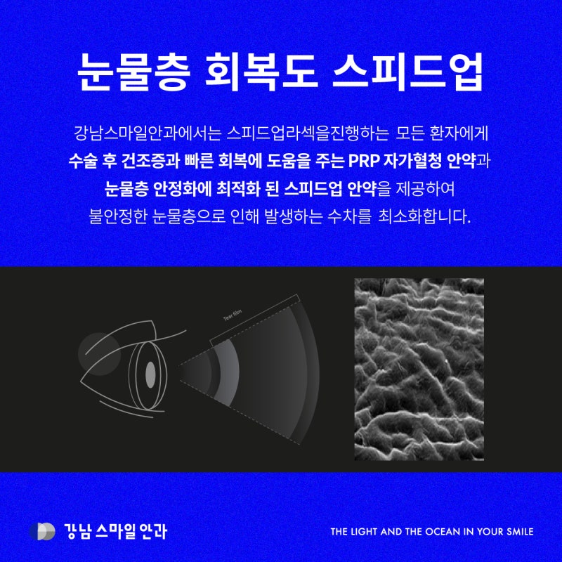 [시력교정술의 비밀] 근시 난시만 없애는 게 중요한 게 아니라구요? (Feat.고위수차와 저위수차) 사진 6
