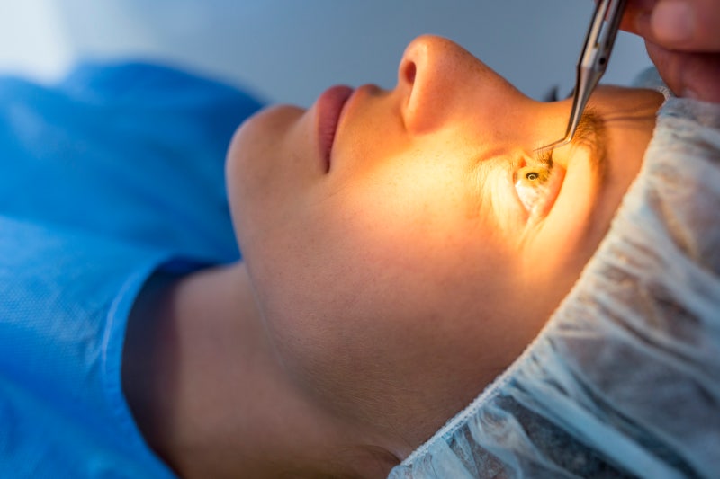 レーシックと二重まぶた手術、どちらが先？＋レーシック二重まぶた回復期間 사진 4