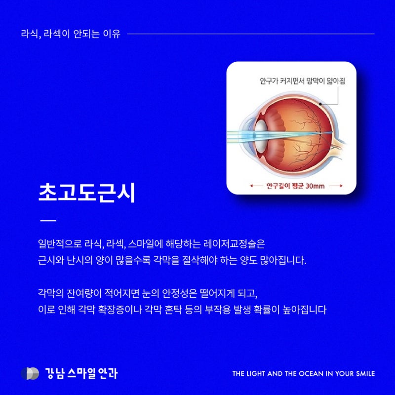 เป็นไปไม่ได้ที่ฉันจะทำ LASIK, LASEK ไม่ได้? กรณีที่ไม่สามารถทำได้และวิธีแก้ไข