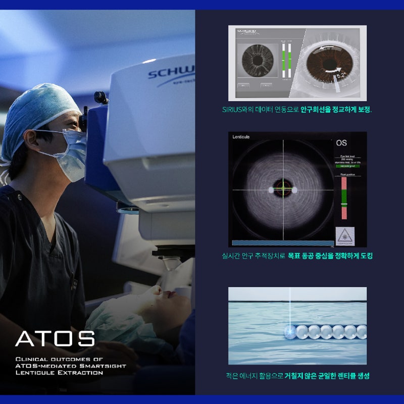 LASIK Eligibility Age for Students (Feat. Vision Correction Age and Precautions) 사진 6