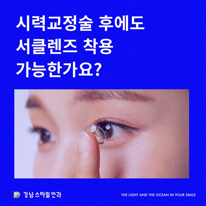 微笑激光手术后多久可以戴美瞳？